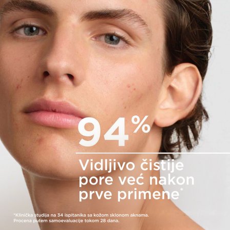 Sebium losion za vidljivo čistije pore