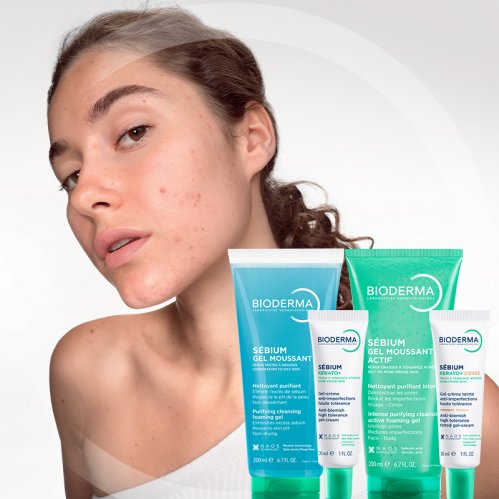 Sebium koža sklona aknama