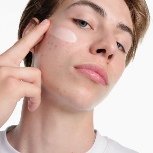 Sebium Kerato+ upotreba